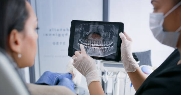 Licensed Tooth Extraction service in Milledgeville, GA - Smile Center Dentistry